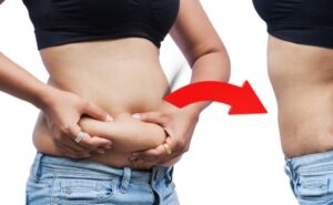 How Misunderstanding Weight Gain After Hysterectomy Creates Problems: