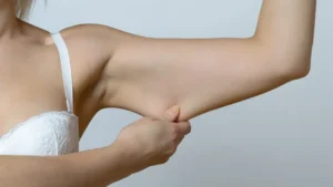 What Hydration Does for Loose Skin After Weight Loss