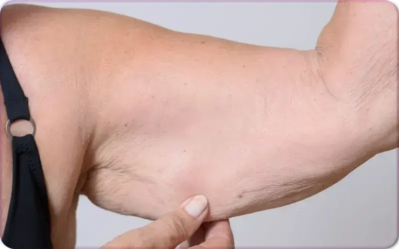 How to Tighten Loose Skin After Weight Loss - 7 Amazing Results!