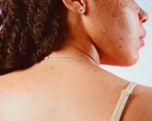 Does Lupus Cause Weight Gain - 7 Honest Truths Revealed!