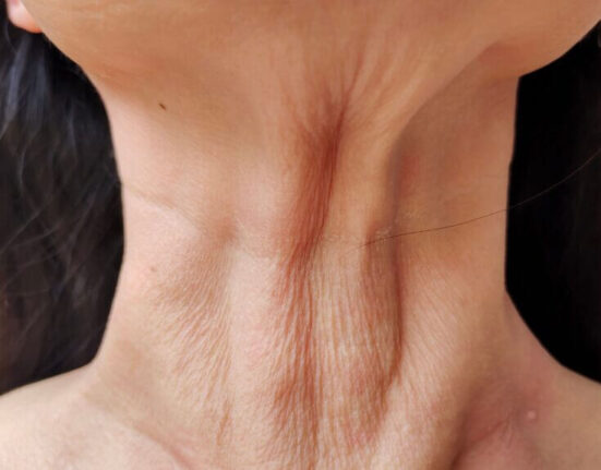 How to Tighten Skin After Weight Loss - 7 Proven Secrets!