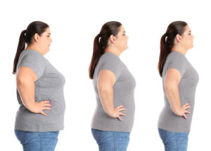 Why Weight Loss Images Before and After Go Viral (And Why That's a Problem):