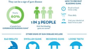 Treatment Options for Bleeding Gums