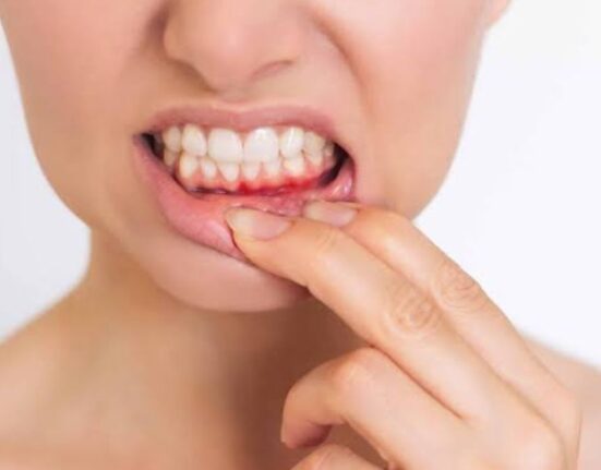 Bleeding Gums - 7 Powerful Causes You Should Never Ignore